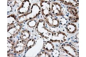Immunohistochemical staining of paraffin-embedded Kidney tissue using anti-FAHD2Amouse monoclonal antibody. (FAHD2A anticorps)