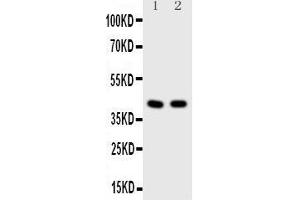 Observed bind size: 42KD (HDAC8 anticorps  (N-Term))