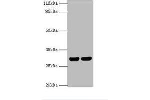 Western Blotting (WB) image for anti-Major Histocompatibility Complex, Class II, DR beta 1 (HLA-DRB1) (AA 30-266) antibody (ABIN6068471) (HLA-DRB1 anticorps  (AA 30-266))