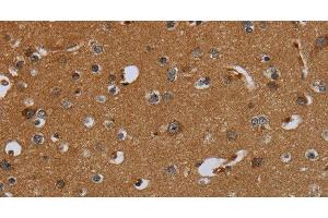 Immunohistochemistry of paraffin-embedded Human brain using PCK2 Polyclonal Antibody at dilution of 1:60