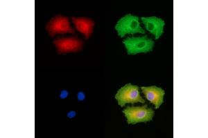 ABIN6265057 and ABIN6279818 staining  cells by IF/ICC. (SH3GL3 anticorps  (Internal Region))