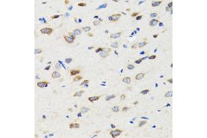 Immunohistochemistry of paraffin-embedded rat brain using SI antibody (ABIN3016131, ABIN3016132, ABIN3016133 and ABIN6219568) at dilution of 1:100 (40x lens).