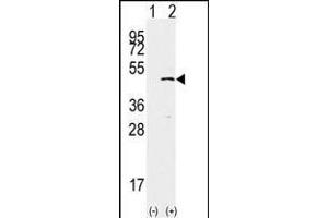 Western blot analysis of SET9(arrow) using rabbit polyclonal SET9 Antibody (ABIN387997 and ABIN2845289). (SETD7 anticorps  (AA 159-189))