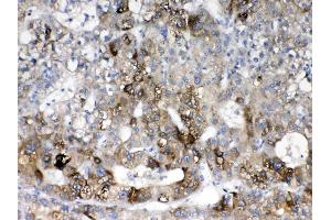 IHC analysis of Cytochrome P450 2D6 using anti- Cytochrome P450 2D6 antibody .