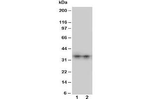 Western blot testing of Aquaporin 8 antibody and Lane 1:  SW620;  2: COLO320 cell lysate. (Aquaporin 8 anticorps  (N-Term))