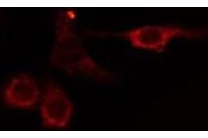 ABIN6275049 staining HuvEc cells by IF/ICC. (AGBL2 anticorps  (C-Term))