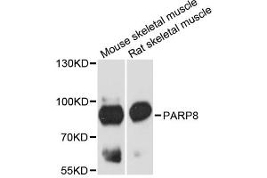 Western blot analysis of extracts of various cell lines, using PARP8 antibody. (PARP8 anticorps)