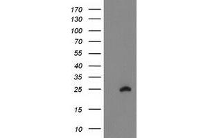 Western Blotting (WB) image for anti-Family With Sequence Similarity 119A (FAM119A) antibody (ABIN1498599) (FAM119A anticorps)