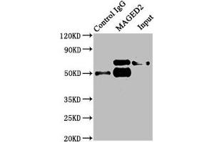 Immunoprecipitating MAGED2 in HepG2 whole cell lysate Lane 1: Rabbit control IgG instead of ABIN7159296 in HepG2 whole cell lysate. (MAGED2 anticorps  (AA 38-285))