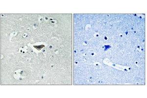 Immunohistochemical analysis of paraffin-embedded human brain tissue using Ras-GRF1 (Phospho-Ser916) antibody (left)or the same antibody preincubated with blocking peptide (right). (RASGRF1 anticorps  (pSer916))