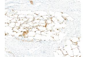 Immunohistochemistry (IHC) image for anti-CD36 (CD36) (AA 30-439) antibody (ABIN7449417) (Recombinant CD36 anticorps  (AA 30-439))