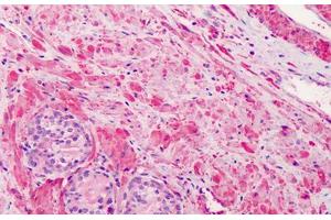 Human Prostate: Formalin-Fixed, Paraffin-Embedded (FFPE)