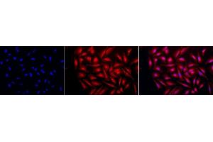 Immunocytochemistry/Immunofluorescence analysis using Rabbit Anti-GRP94 Polyclonal Antibody (ABIN1686652 and ABIN1686653).