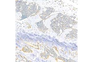 Immunohistochemistry analysis of paraffin-embedded mouse bone using Eif2ak1 (ABIN7073875) at dilution of 1: 1000 (EIF2AK1 anticorps)