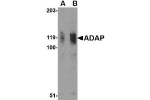 Western blot analysis of ADAP in K562 cell lysate with AP30020PU-N ADAP antibody at (A) 0.