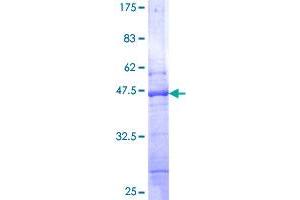 Image no. 1 for BCL2-Interacting Killer (Apoptosis-Inducing) (BIK) (AA 1-160) protein (GST tag) (ABIN1346675)