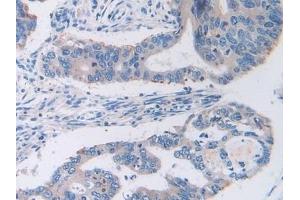 anti-Transferrin Receptor (p90, CD71) (TFRC) (AA 567-744) antibody