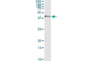 Immunoprecipitation of SGOL1 transfected lysate using anti-SGOL1 monoclonal antibody and Protein A Magnetic Bead , and immunoblotted with SGOL1 MaxPab rabbit polyclonal antibody.