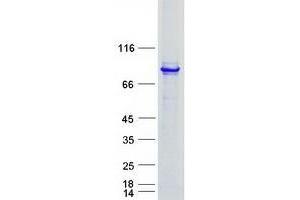 Validation with Western Blot