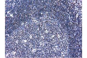 Immunohistochemical staining of paraffin-embedded Human lymph node tissue using anti-ANKRD53 mouse monoclonal antibody. (ANKRD53 anticorps  (AA 1-300))