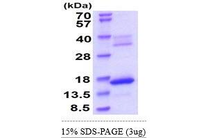 SDS-PAGE (SDS) image for Hemoglobin, zeta (HBZ) (AA 1-142) protein (His tag) (ABIN5855086)