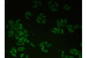 Detection of CTNNa1 in Human Hela Cells using Polyclonal Antibody to Catenin Alpha 1 (CTNNa1) (CTNNA1 anticorps  (AA 2-228))