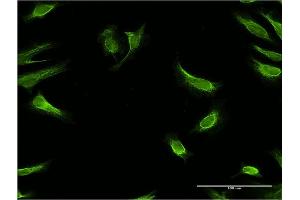Immunofluorescence of monoclonal antibody to RBP7 on HeLa cell.