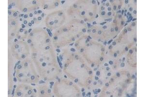 Detection of RAGE in Rat Kidney Tissue using Polyclonal Antibody to Receptor For Advanced Glycation Endproducts (RAGE)