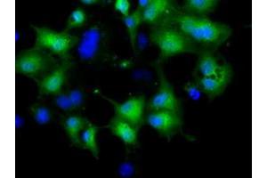 Anti-CRYM mouse monoclonal antibody (ABIN2452922) immunofluorescent staining of COS7 cells transiently transfected by pCMV6-ENTRY CRYM (RC218123). (CRYM anticorps)