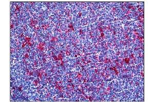 Immunohistochemistry (IHC) image for anti-Gelsolin (GSN) antibody (ABIN781885) (Gelsolin anticorps)