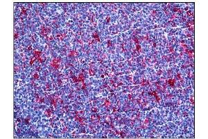Immunohistochemistry (IHC) image for anti-Gelsolin (GSN) antibody (ABIN781885) (Gelsolin anticorps)