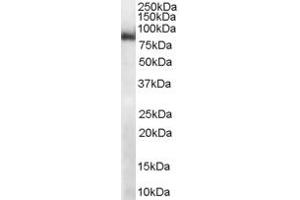 ABIN184920 (1µg/ml) staining of mouse heart lysate (RIPA buffer, 35µg total protein per lane). (Midline 2 anticorps  (C-Term))