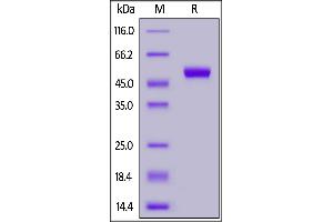 Fed Human CD5, His Tag on  under reducing (R) condition.