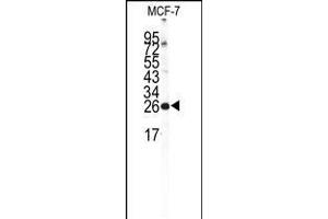 Western blot analysis of NCS1 Antibody in MCF-7 cell line lysates (35ug/lane) (NCS1 anticorps  (AA 118-144))