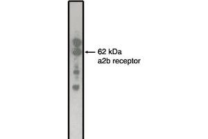 Western Blotting (WB) image for anti-Adrenergic, alpha-2B-, Receptor (ADRA2B) antibody (ABIN264463)