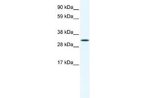 WB Suggested Anti-AIP Antibody Titration:  1. (AIP anticorps  (N-Term))