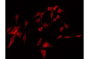 ABIN6274416 staining Hela by IF/ICC. (AKAP14 anticorps  (N-Term))