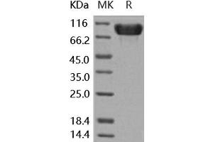 Western Blotting (WB) image for Fibronectin (Active) protein (His tag) (ABIN7195790) (Fibronectin Protein (His tag))