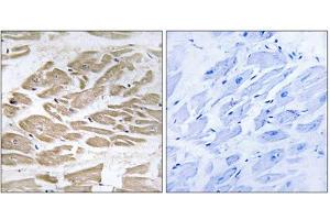 Immunohistochemistry analysis of paraffin-embedded human heart tissue using BRP44L antibody. (BRP44L anticorps  (N-Term))