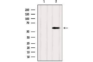 Western blot analysis of extracts from Mouse brain, using SUOX Antibody. (SUOX anticorps  (Internal Region))