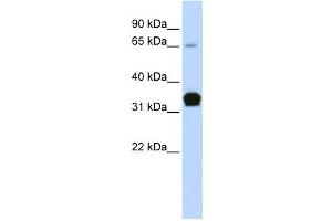 Western Blotting (WB) image for anti-Slow Skeletal Troponin T (TNNT1) antibody (ABIN2458625) (TNNT1 anticorps)