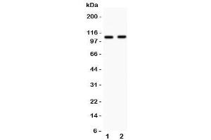 Western blot testing of Nod1 antibody and Lane 1:  human A549 (NOD1 anticorps  (AA 1-160))