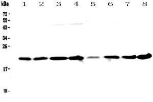 Western blot analysis of GLO1 using anti-GLO1 antibody . (GLO1 anticorps  (AA 2-184))