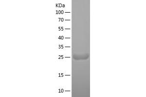 Western Blotting (WB) image for Myosin Light Chain 4, Alkali, Atrial, Embryonic (MYL4) (AA 1-197) protein (His tag) (ABIN7124061)
