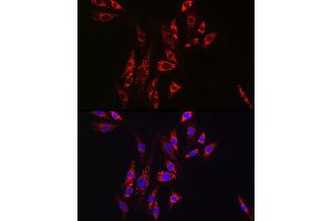 Immunofluorescence analysis of NIH-3T3 cells using [KO Validated] Hexokinase II Rabbit pAb (ABIN3021255, ABIN3021256, ABIN3021257 and ABIN6214088) at dilution of 1:100 (40x lens).
