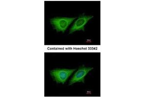 ICC/IF Image Immunofluorescence analysis of methanol-fixed HeLa, using LOC80129, antibody at 1:200 dilution. (CCDC170 anticorps  (C-Term))
