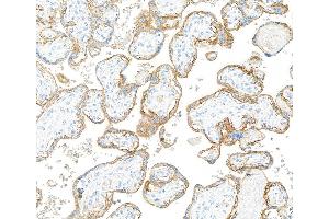 Immunohistochemistry (IHC) image for anti-Epidermal Growth Factor Receptor (EGFR) (C-Term) antibody (ABIN7795642) (Recombinant EGFR anticorps  (C-Term))