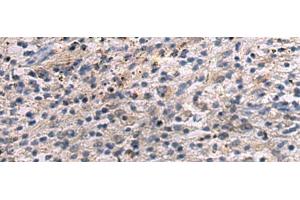 Immunohistochemistry of paraffin-embedded Human brain tissue using ANGPTL2 Polyclonal Antibody at dilution of 1:55(x200)