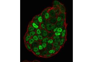 Immunofluorescence Analysis of PFA-fixed MCF-7 cells labeling p27 with p27 Mouse Monoclonal Antibody (SX53G8) followed by Goat anti-Mouse IgG-CF488 (Green). (CDKN1B anticorps)