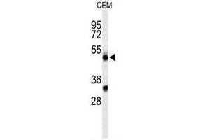 Western blot analysis of CFP Antibody (Center) in CEM cell line lysates (35µg/lane). (CFP anticorps  (Middle Region))